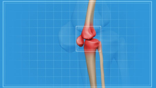 Ont i knät - ortopedi